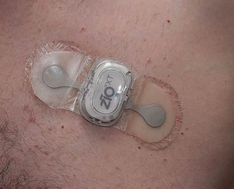 loop heart monitor